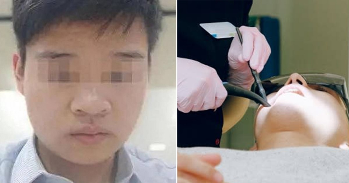 kehidupan-sisa-hari-pria-cina-yang-tewas-setelah-prosedur-gigi-yang-berat